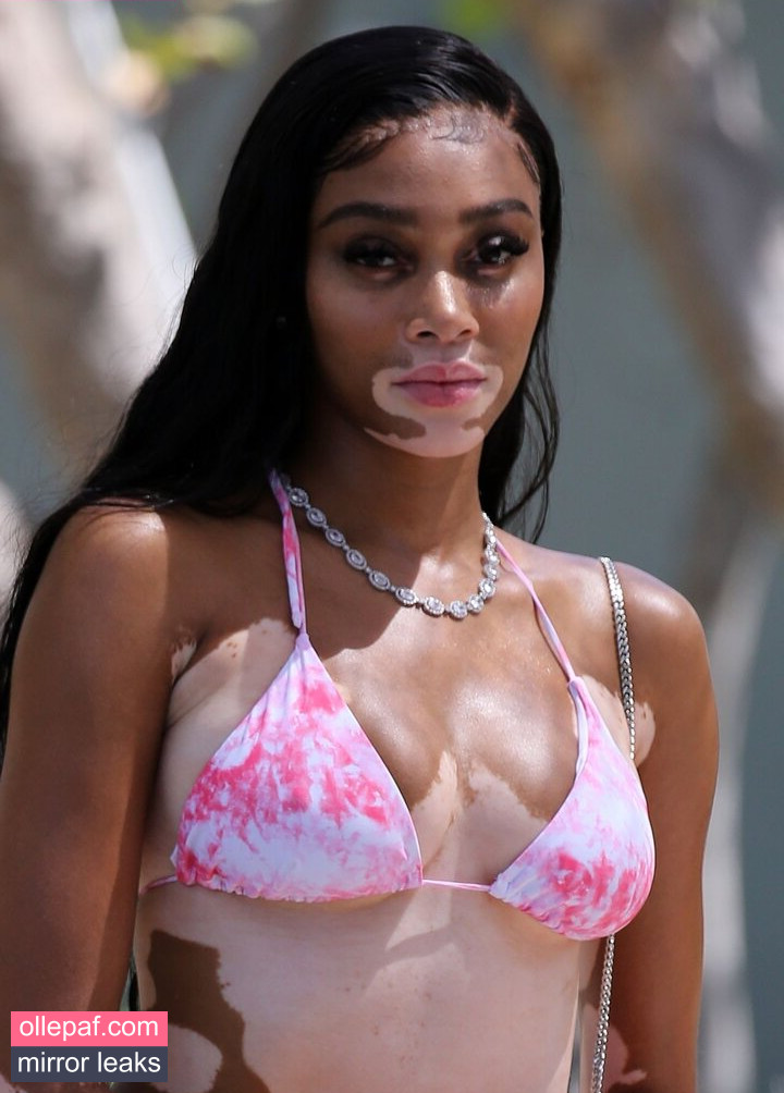 Latest Leaks Winnie Harlow Nude #107 - Fapello