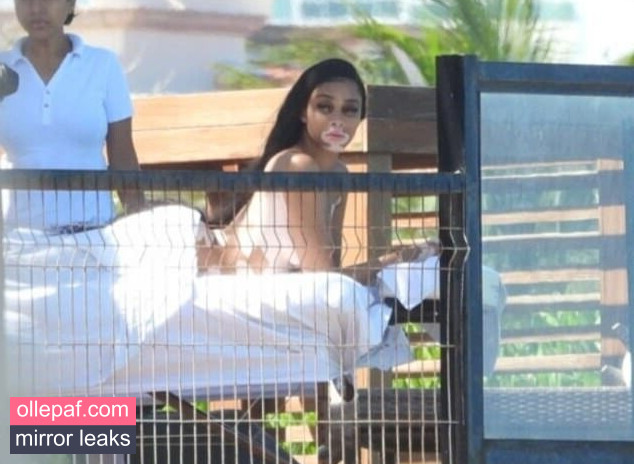 Latest Leaks Winnie Harlow Nude #134 - Fapello