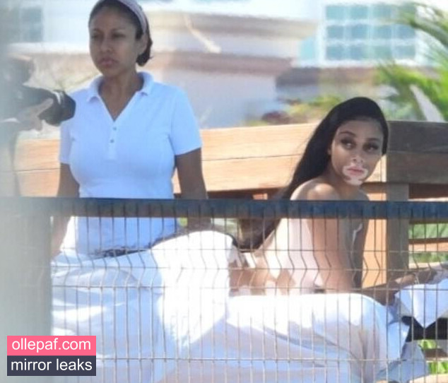 Latest Leaks Winnie Harlow Nude #138 - Fapello