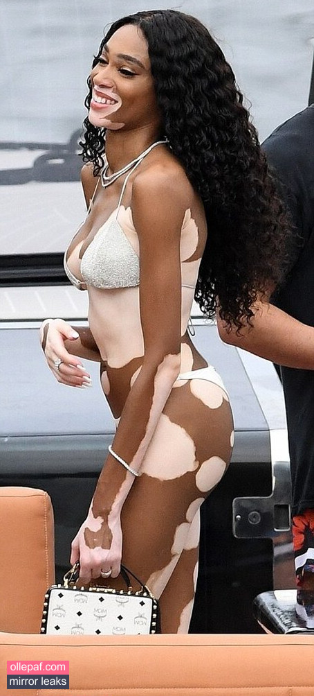 Latest Leaks Winnie Harlow Nude #142 - Fapello
