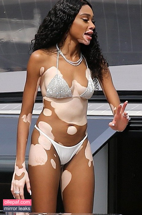 Latest Leaks Winnie Harlow Nude #144 - Fapello