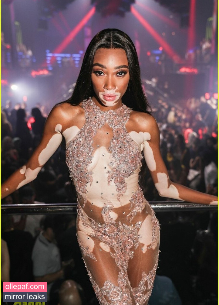 Latest Leaks Winnie Harlow Nude #148 - Fapello