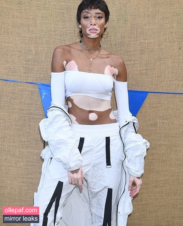 Latest Leaks Winnie Harlow Nude #171 - Fapello