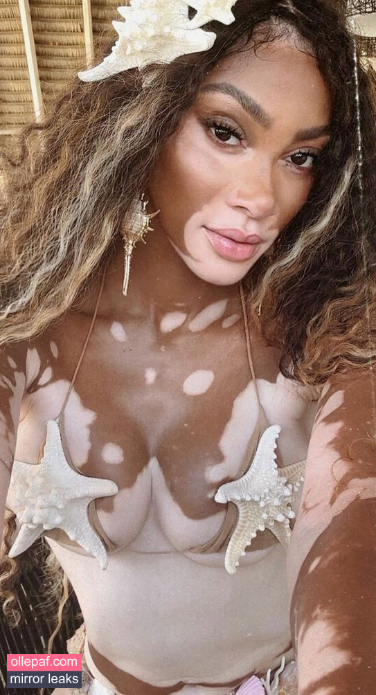 Latest Leaks Winnie Harlow Nude #174 - Fapello