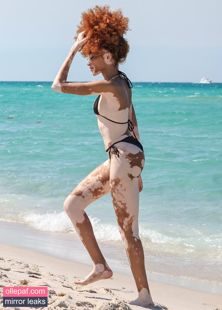 Latest Leaks Winnie Harlow Nude #20 - Fapello