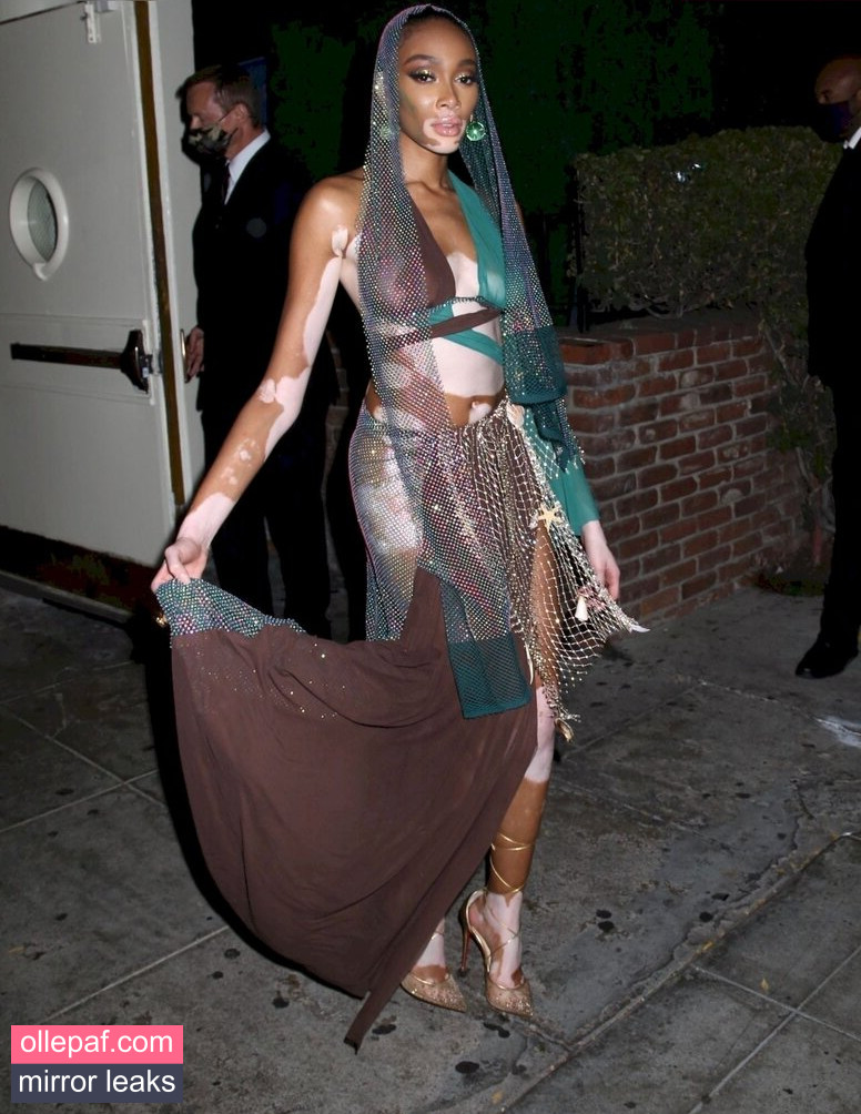 Latest Leaks Winnie Harlow Nude #192 - Fapello