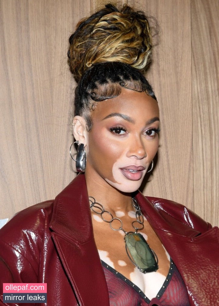 Latest Leaks Winnie Harlow Nude #200 - Fapello