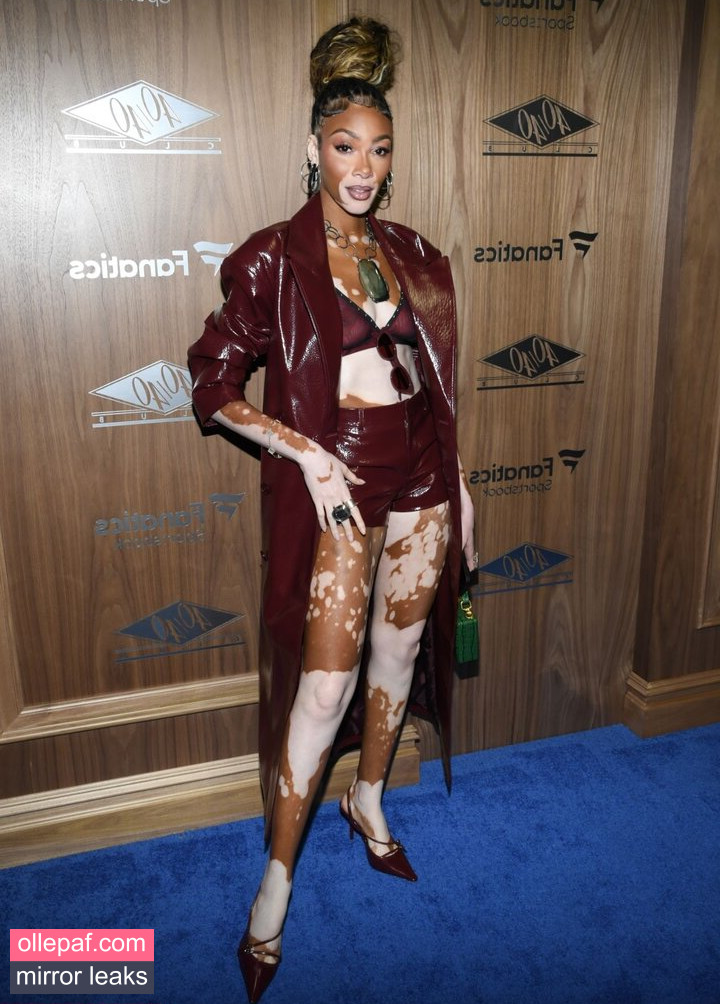 Latest Leaks Winnie Harlow Nude #206 - Fapello