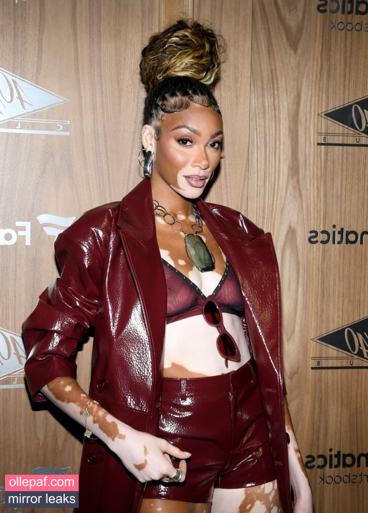 Latest Leaks Winnie Harlow Nude #207 - Fapello