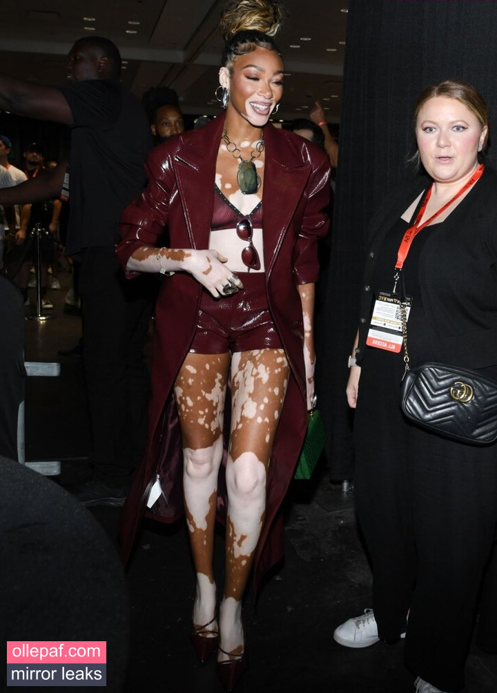 Latest Leaks Winnie Harlow Nude #208 - Fapello