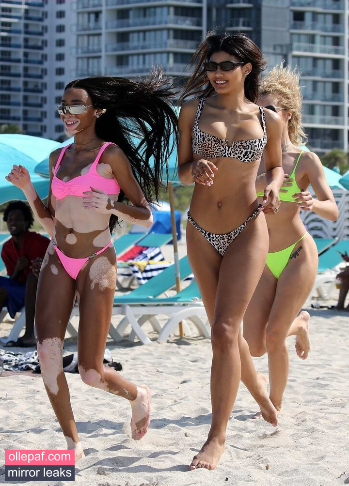 Latest Leaks Winnie Harlow Nude #219 - Fapello