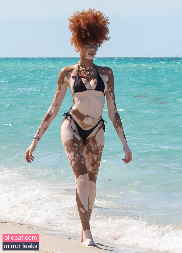 Latest Leaks Winnie Harlow Nude #23 - Fapello