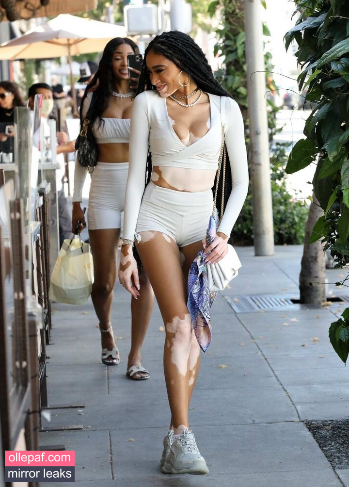 Latest Leaks Winnie Harlow Nude #242 - Fapello