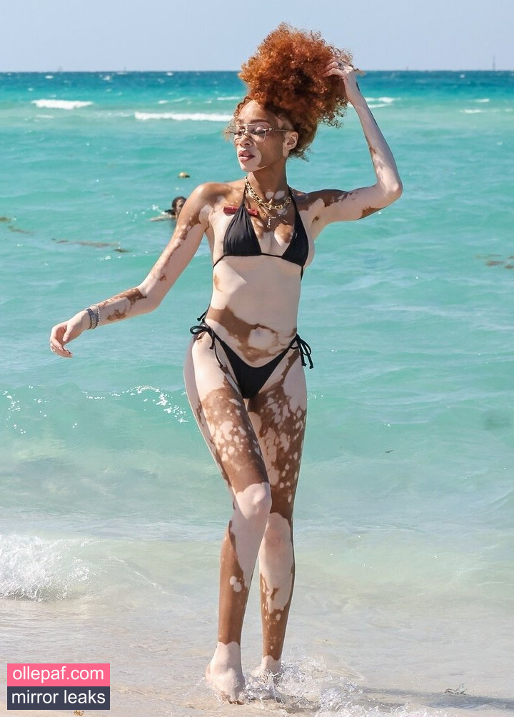 Latest Leaks Winnie Harlow Nude #26 - Fapello