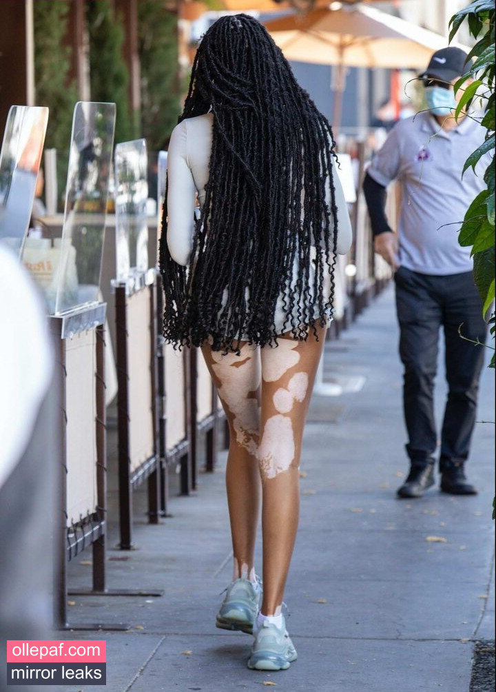 Latest Leaks Winnie Harlow Nude #251 - Fapello