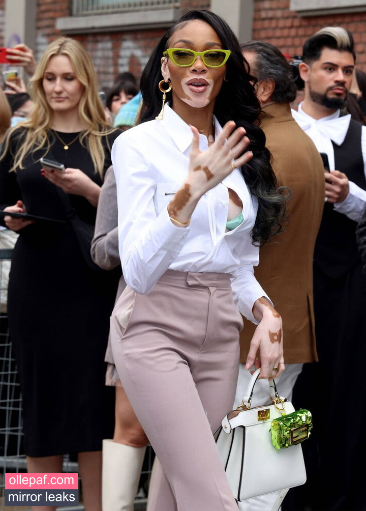 Latest Leaks Winnie Harlow Nude #265 - Fapello