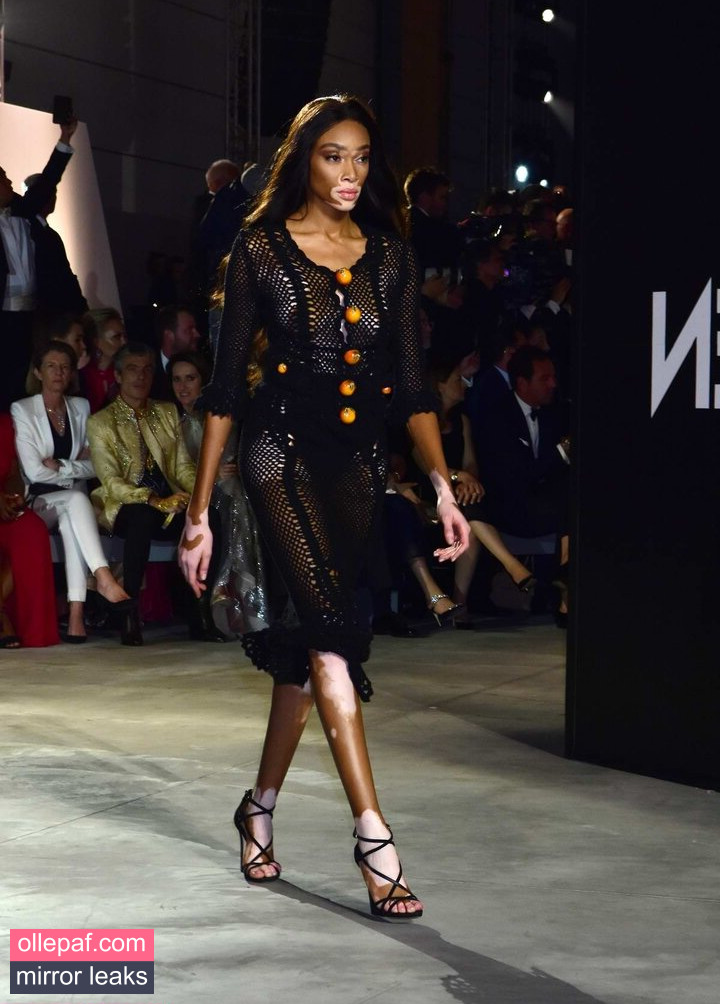 Latest Leaks Winnie Harlow Nude #273 - Fapello