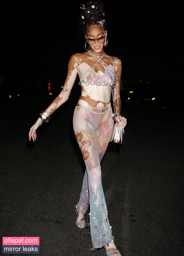 Latest Leaks Winnie Harlow Nude #279 - Fapello