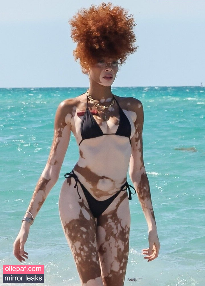 Latest Leaks Winnie Harlow Nude #29 - Fapello