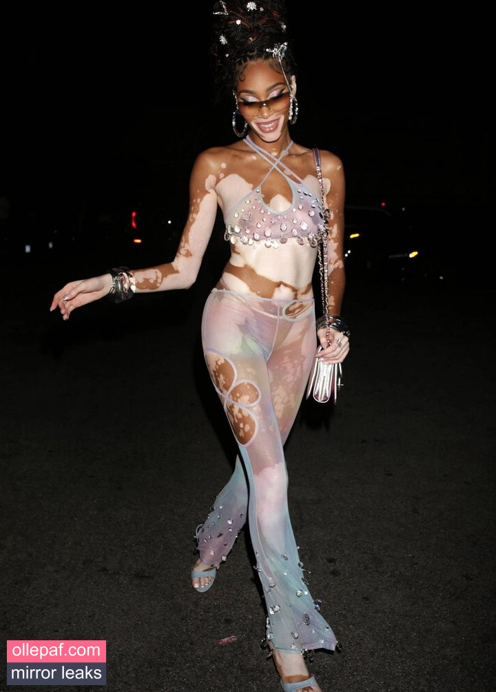 Latest Leaks Winnie Harlow Nude #281 - Fapello