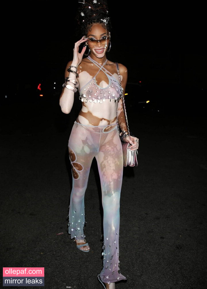 Latest Leaks Winnie Harlow Nude #282 - Fapello