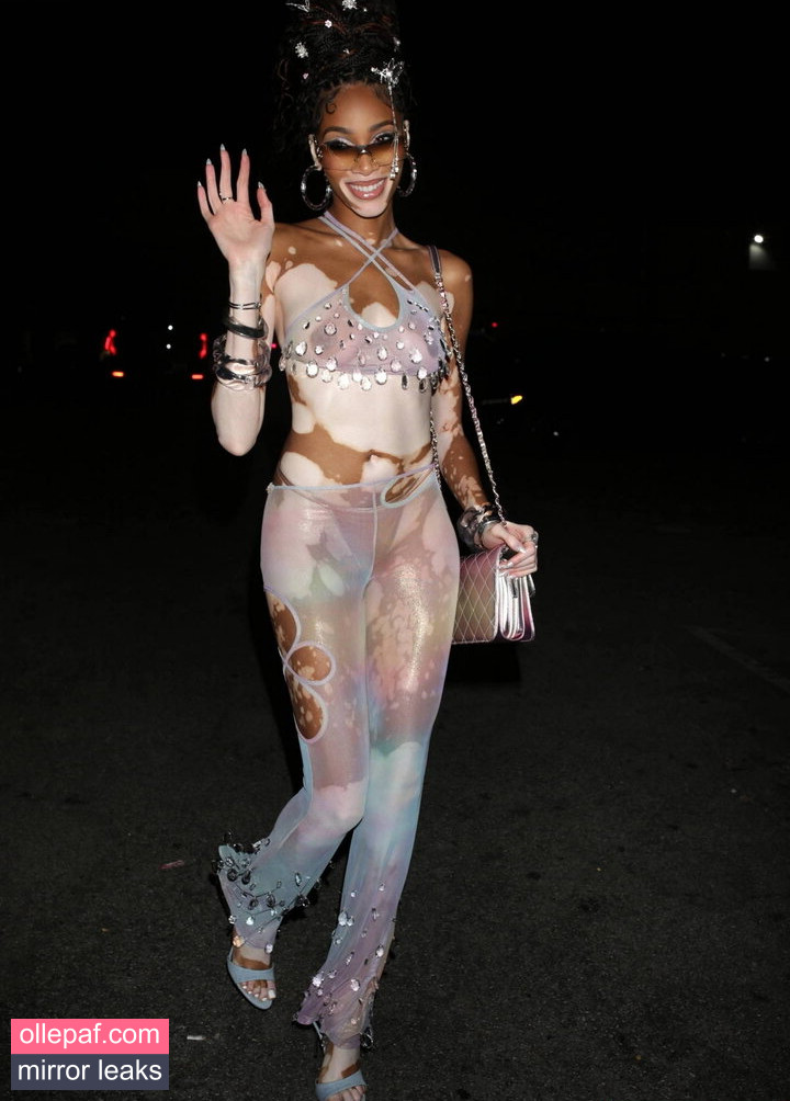 Latest Leaks Winnie Harlow Nude #284 - Fapello