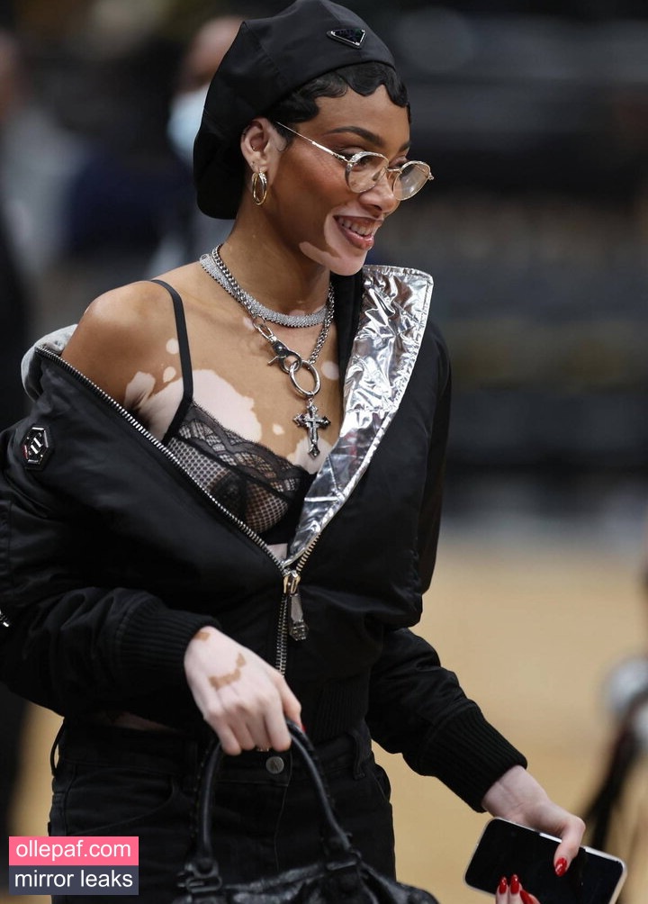 Latest Leaks Winnie Harlow Nude #289 - Fapello