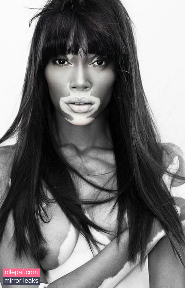 Latest Leaks Winnie Harlow Nude #301 - Fapello