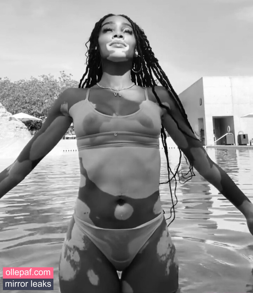Latest Leaks Winnie Harlow Nude #303 - Fapello