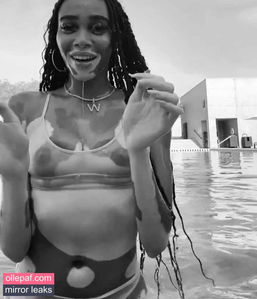 Latest Leaks Winnie Harlow Nude #304 - Fapello