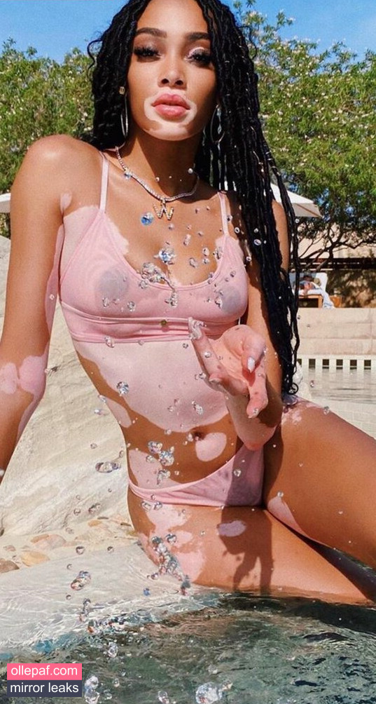 Latest Leaks Winnie Harlow Nude #306 - Fapello