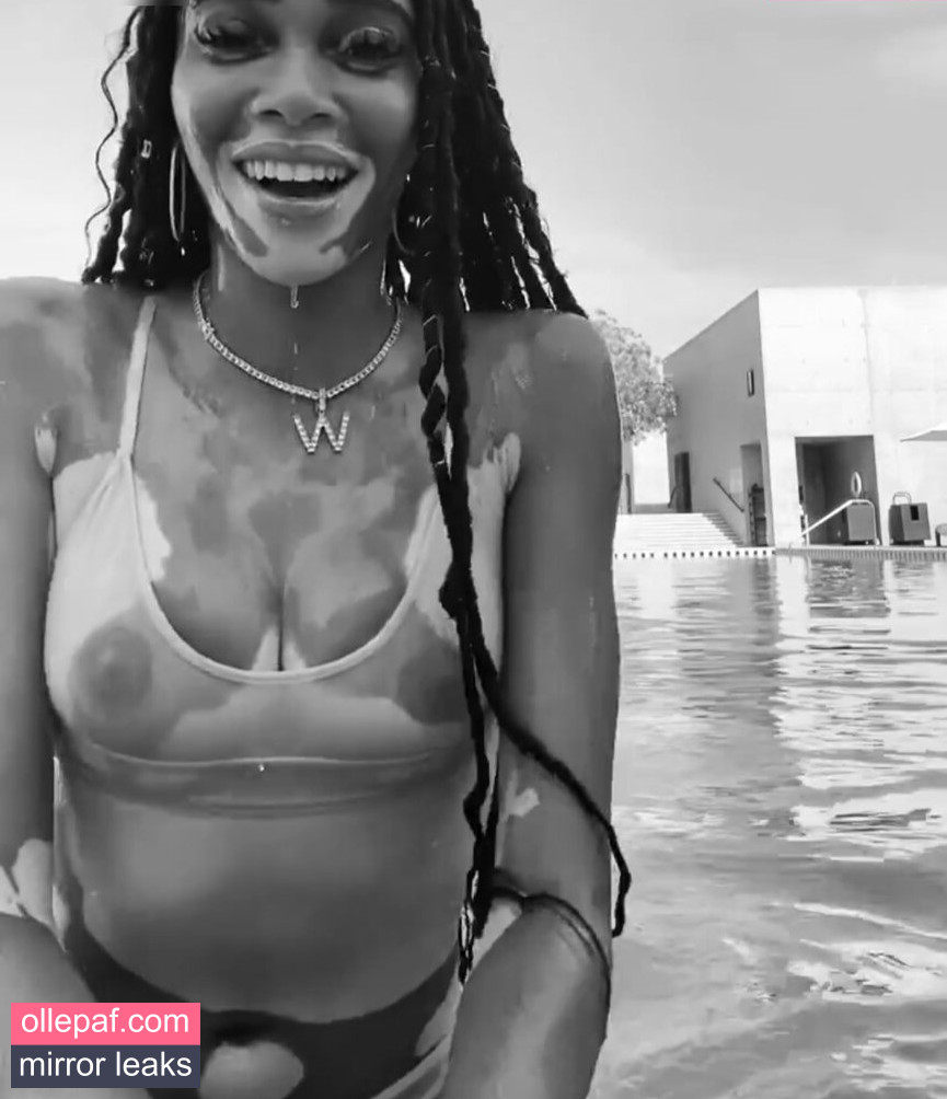 Latest Leaks Winnie Harlow Nude #308 - Fapello