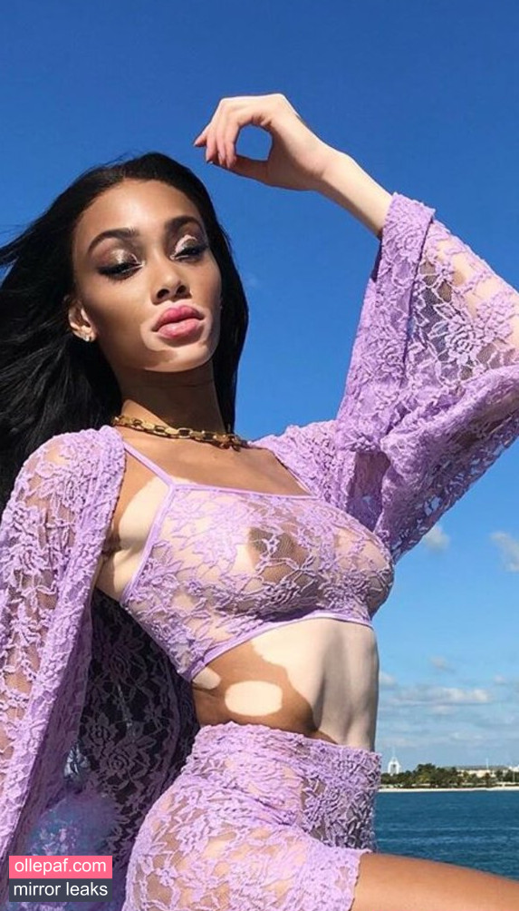 Latest Leaks Winnie Harlow Nude #310 - Fapello