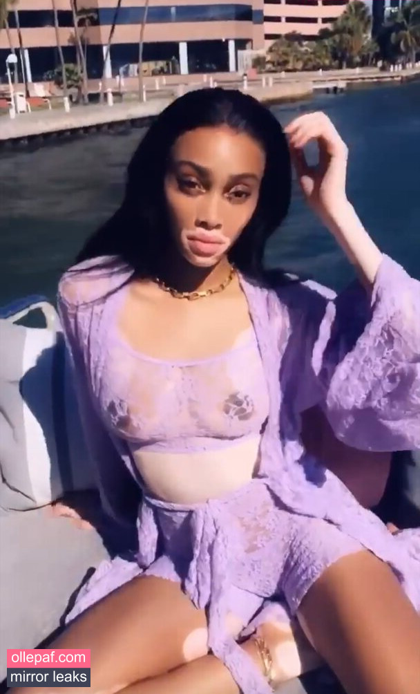 Latest Leaks Winnie Harlow Nude #312 - Fapello