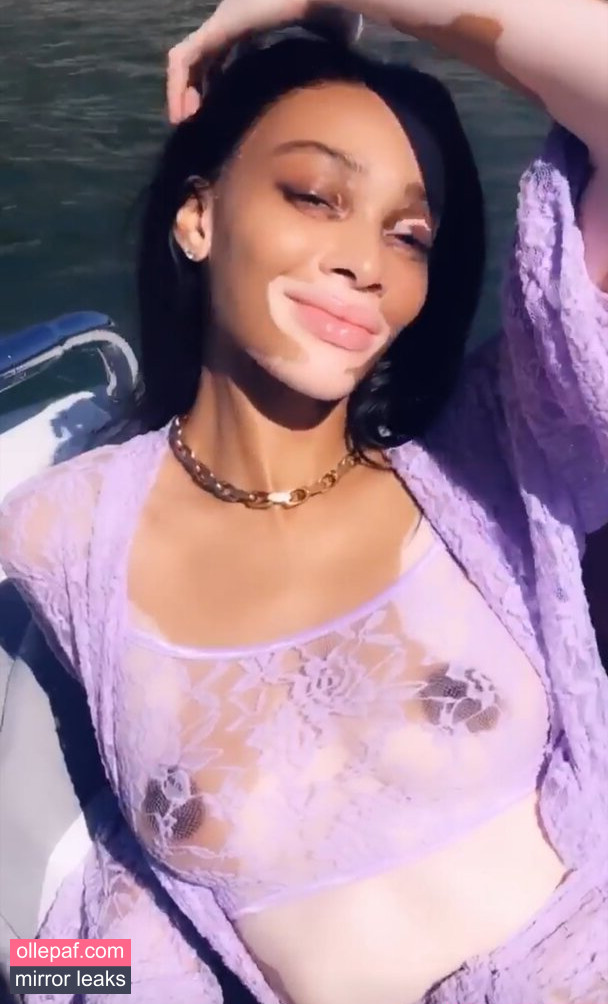 Latest Leaks Winnie Harlow Nude #314 - Fapello