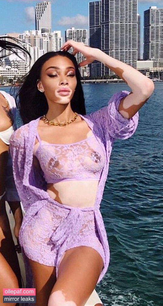 Latest Leaks Winnie Harlow Nude #315 - Fapello