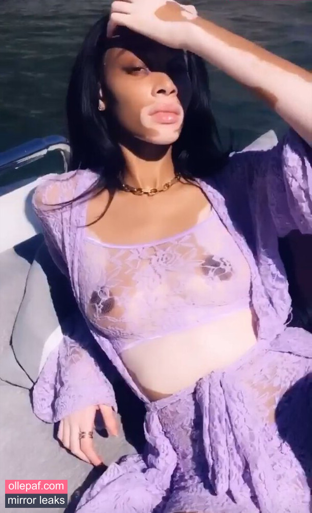 Latest Leaks Winnie Harlow Nude #316 - Fapello