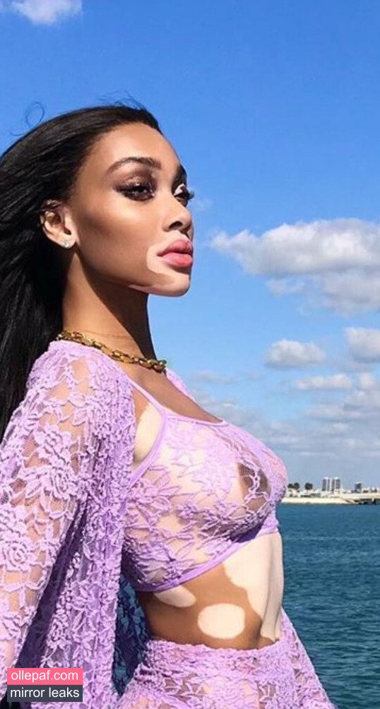 Latest Leaks Winnie Harlow Nude #318 - Fapello