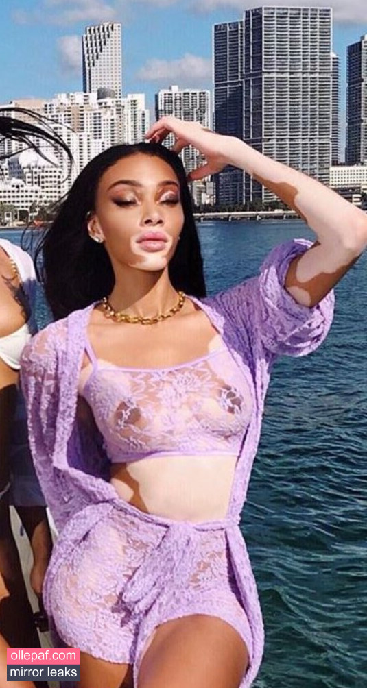 Latest Leaks Winnie Harlow Nude #321 - Fapello