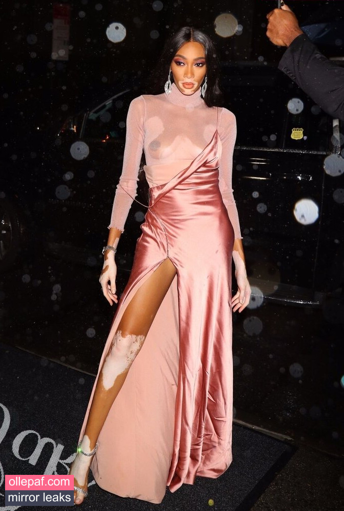 Latest Leaks Winnie Harlow Nude #326 - Fapello