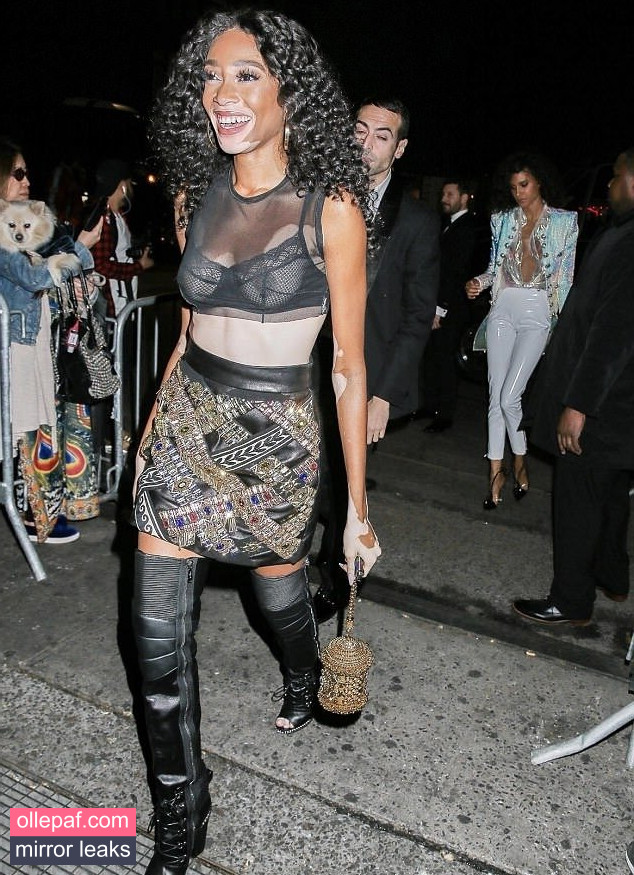 Latest Leaks Winnie Harlow Nude #343 - Fapello