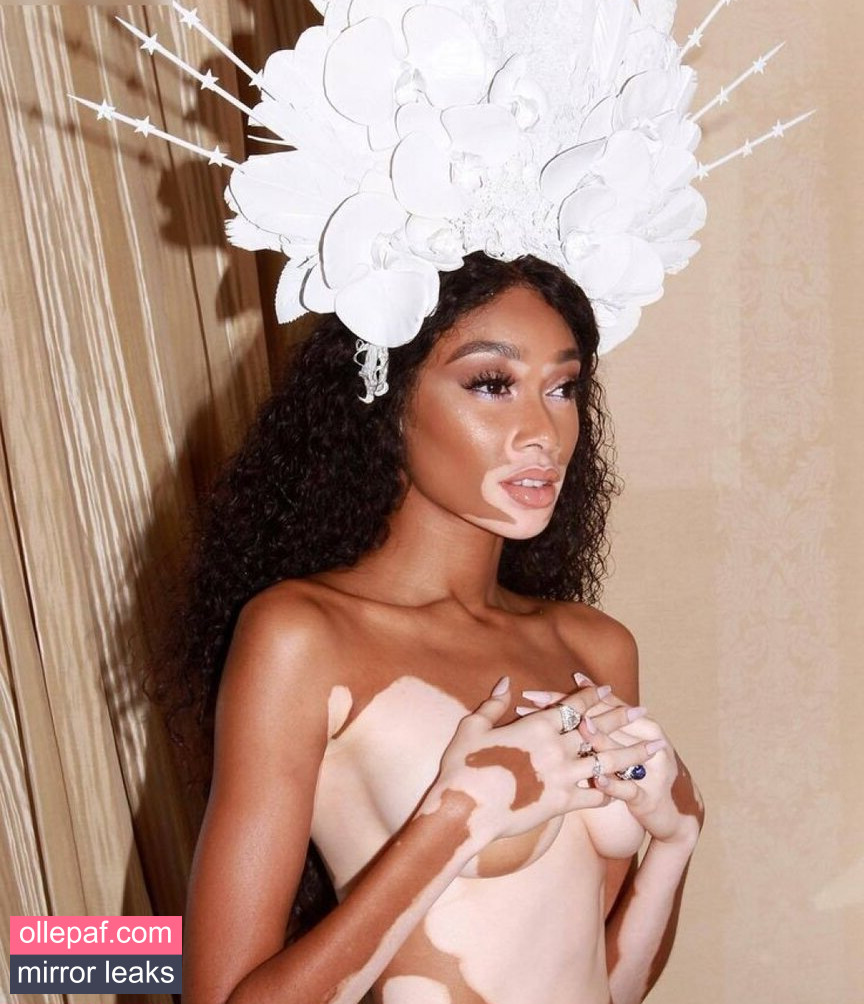 Latest Leaks Winnie Harlow Nude #344 - Fapello