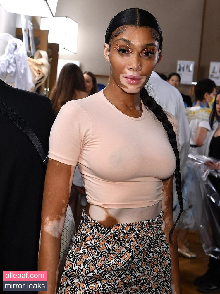 Latest Leaks Winnie Harlow Nude #347 - Fapello
