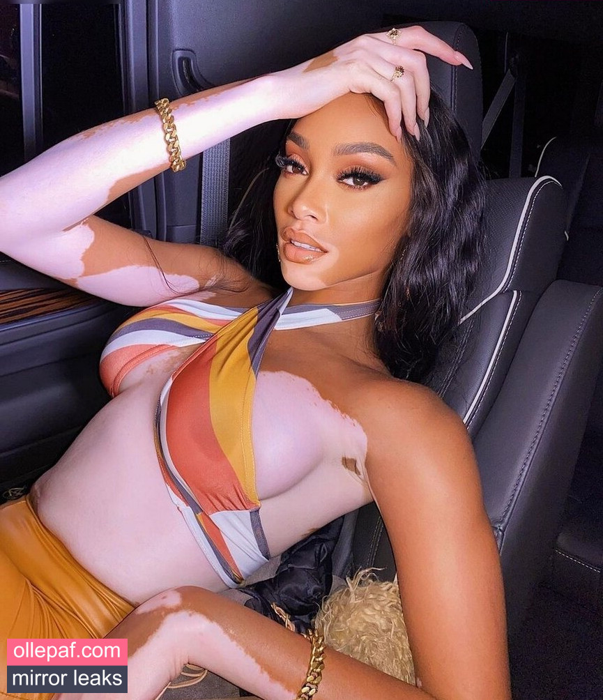 Latest Leaks Winnie Harlow Nude #349 - Fapello