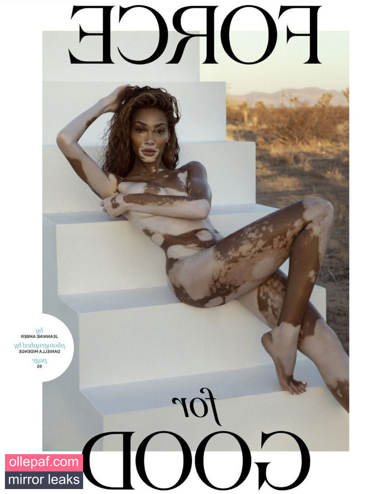 Latest Leaks Winnie Harlow Nude #354 - Fapello