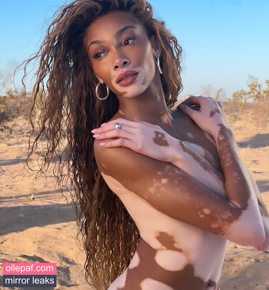 Latest Leaks Winnie Harlow Nude #357 - Fapello