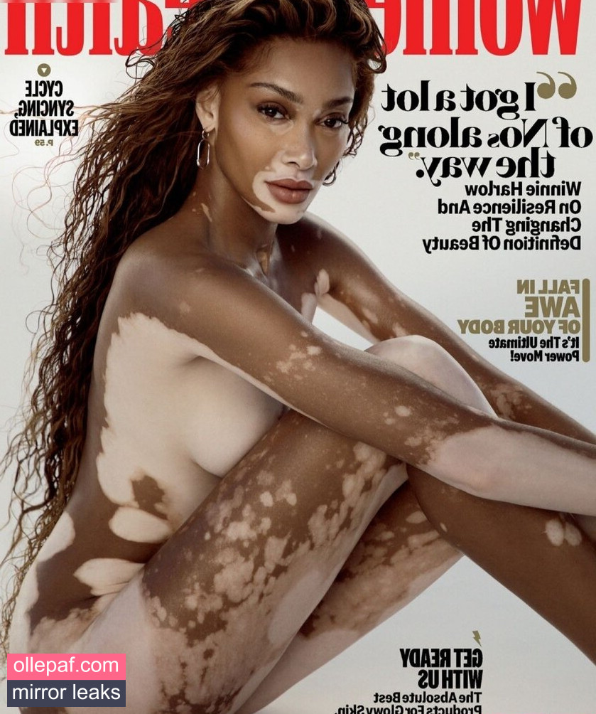 Latest Leaks Winnie Harlow Nude #360 - Fapello