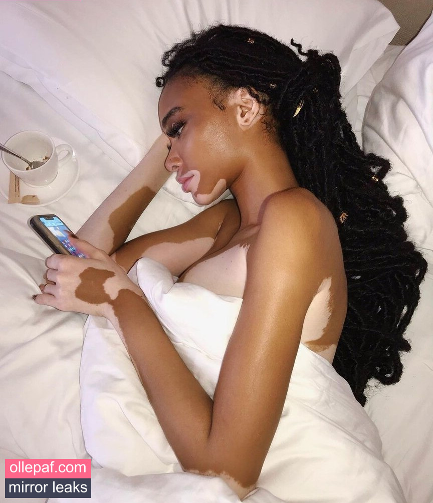 Latest Leaks Winnie Harlow Nude #361 - Fapello
