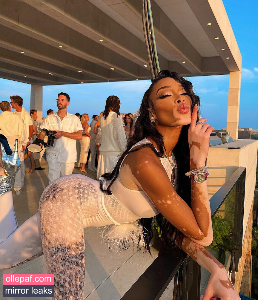 Latest Leaks Winnie Harlow Nude #363 - Fapello