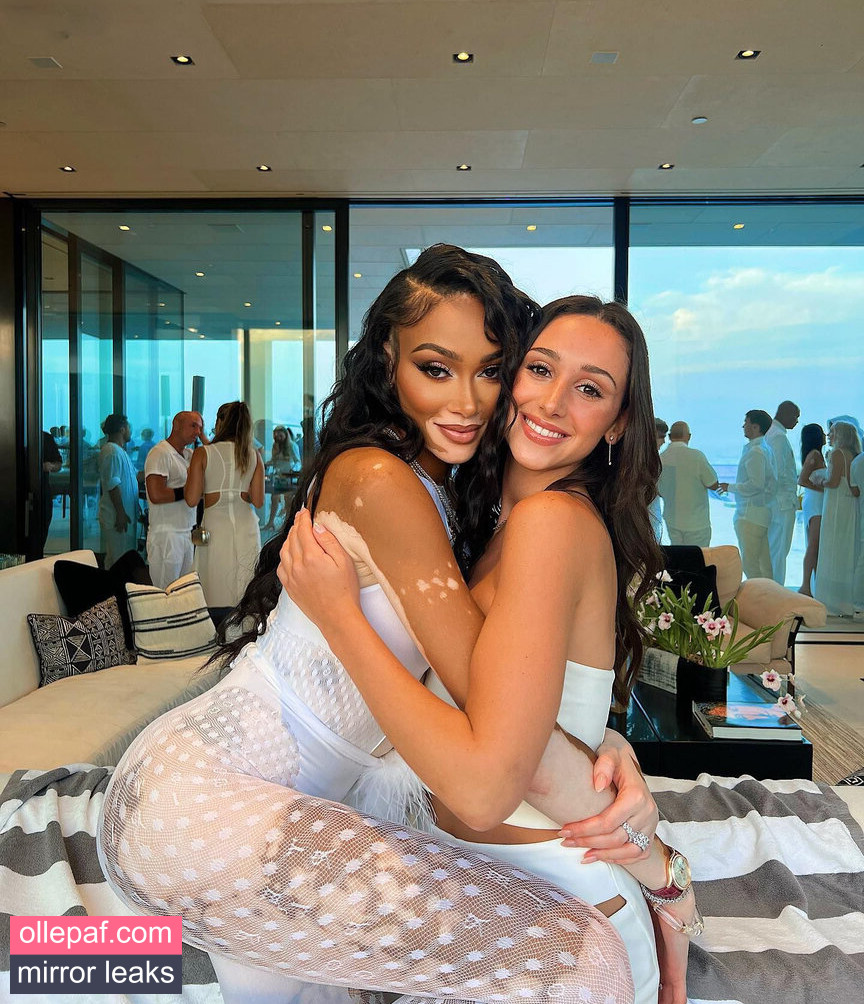 Latest Leaks Winnie Harlow Nude #365 - Fapello